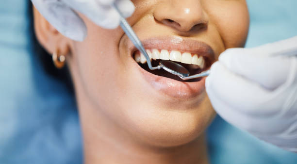 Best Same-Day Emergency Dentist in Heath, TX