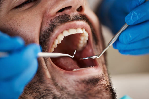 Best After-Hours Emergency Dentist in Heath, TX