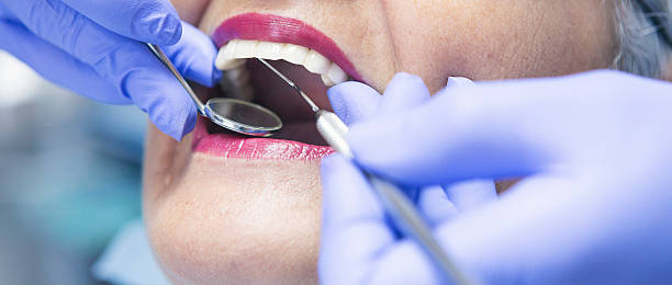 Best Emergency Broken Tooth Repair in Heath, TX